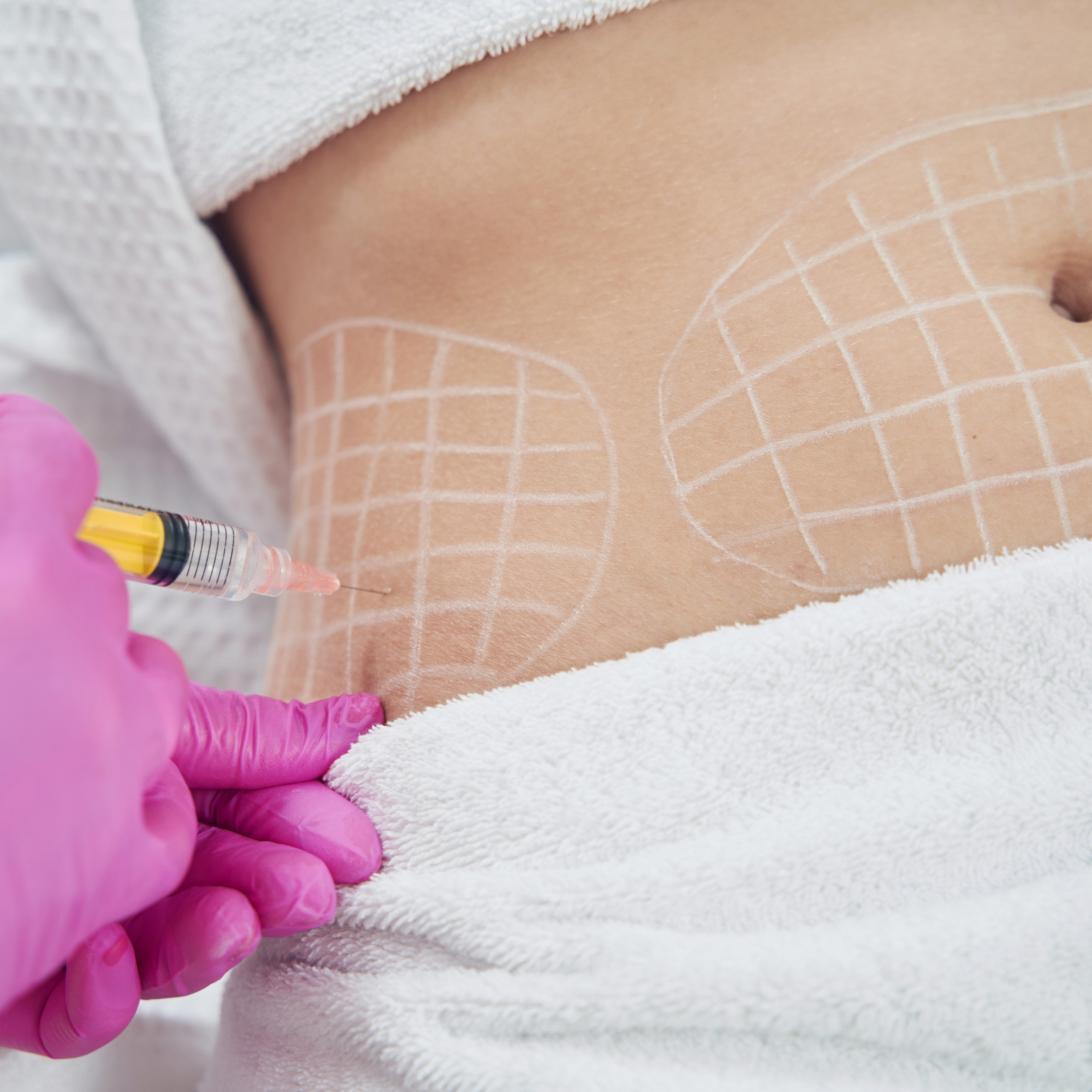 Fat Dissolvers vs. Liposuction: Comparing Non-Invasive and Surgical Options
